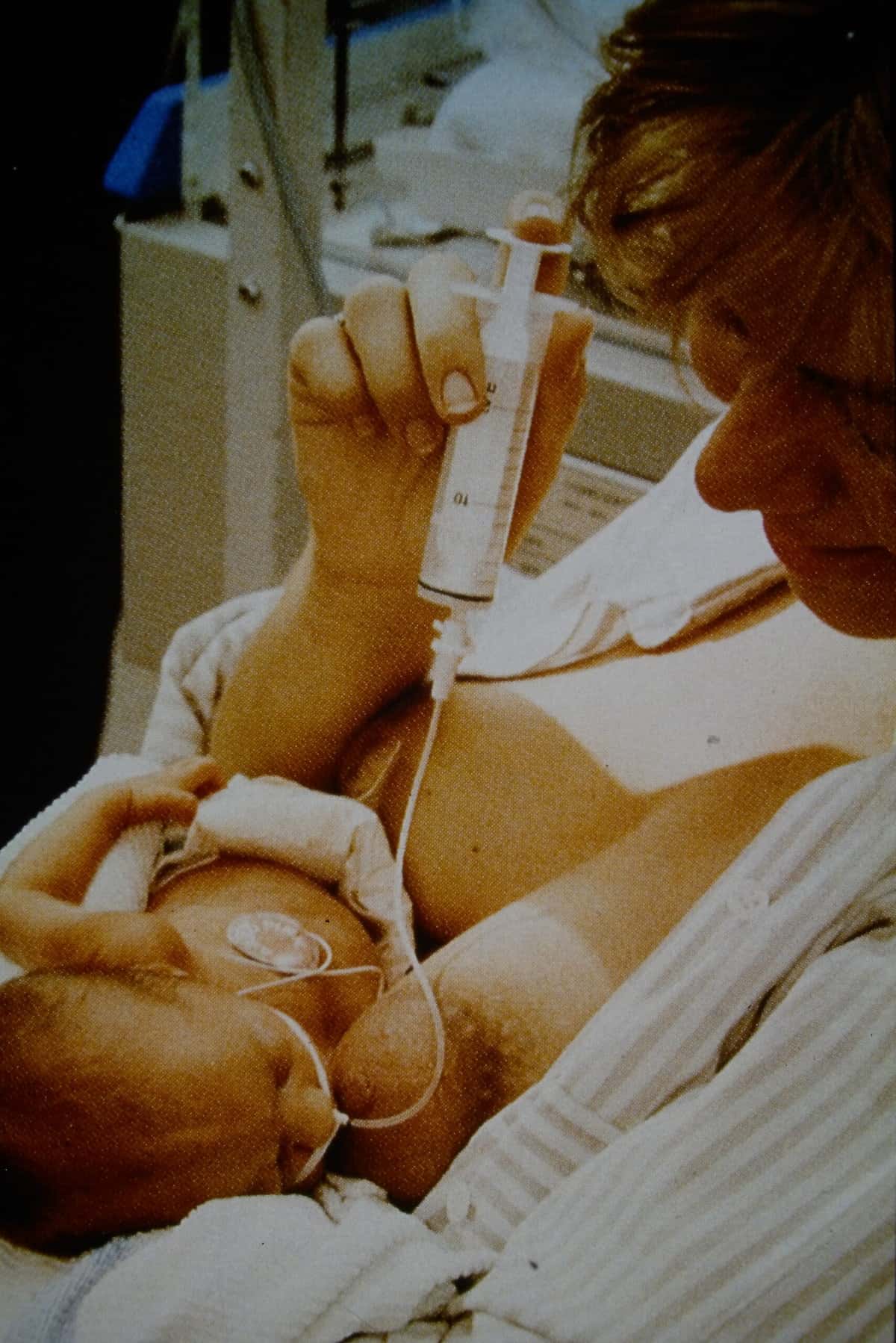 Module 9 - Prematurity, Multiple Births & Technology: Managing Unique Breastfeeding Challenges